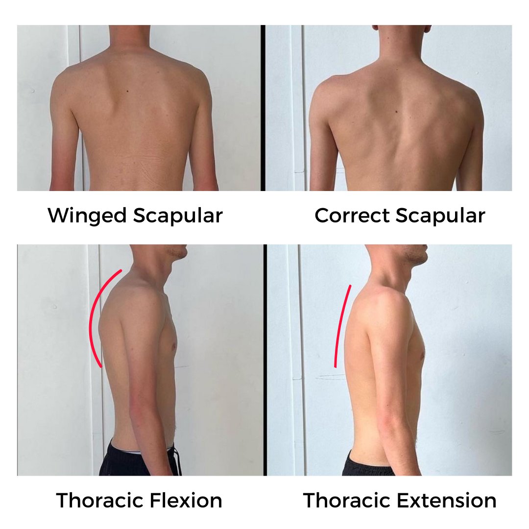 how to fix slumped posture