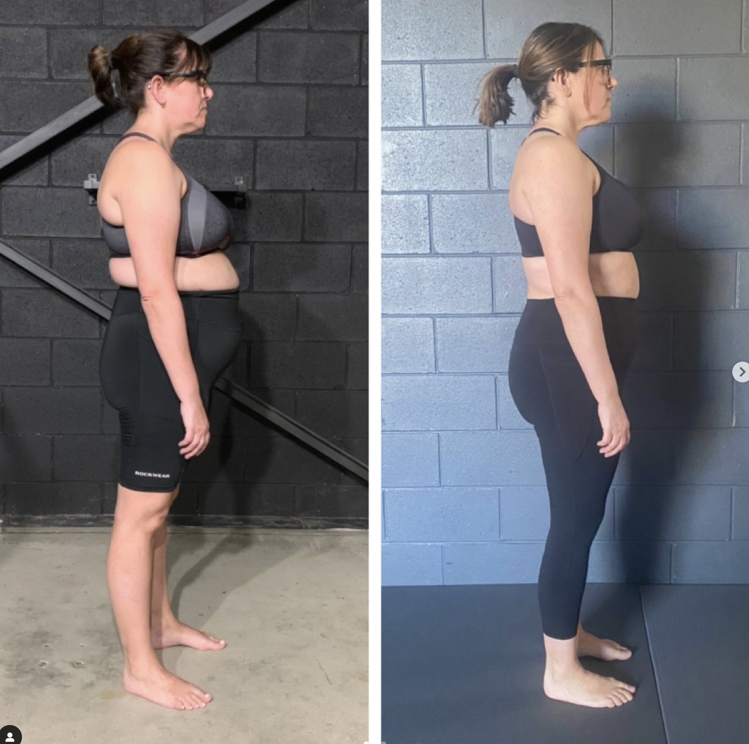 neck hump workout
