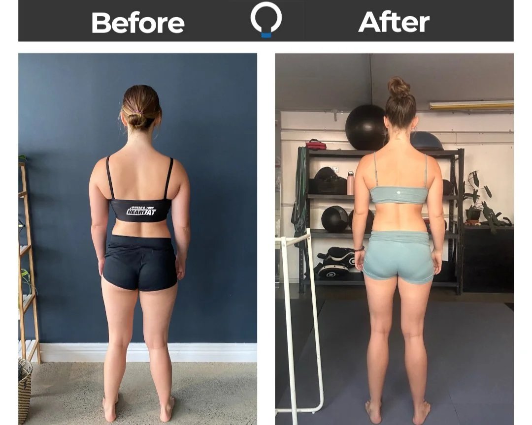posture before and after