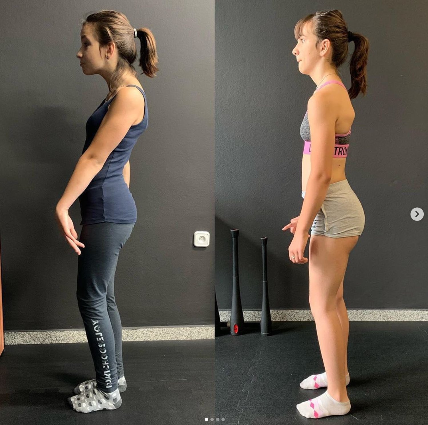 fixing posture in cerebral palsy using functional patterns training